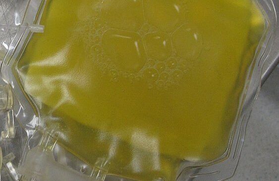 Plasma fresco congelato