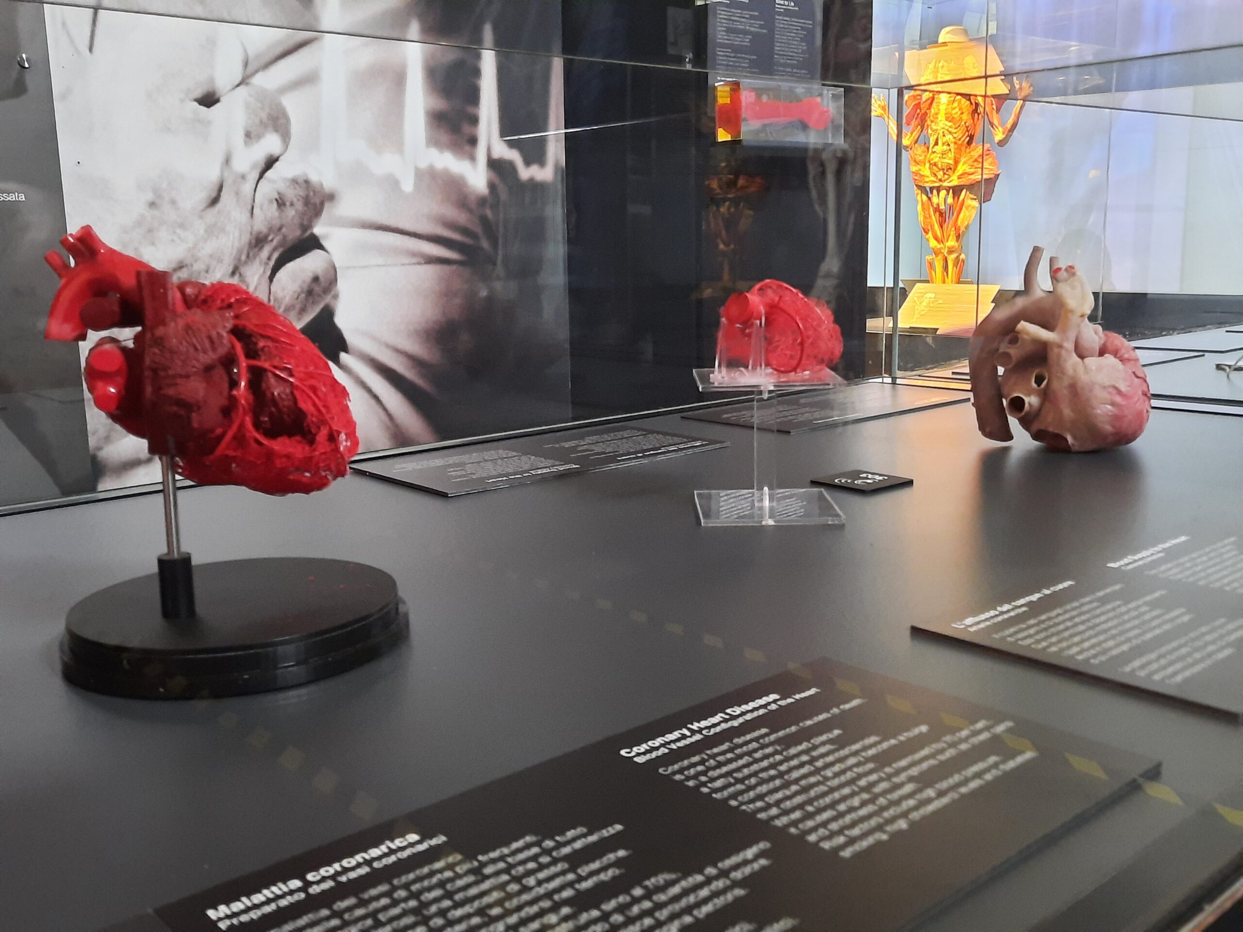 Body worlds vital 17 Quotidiano Piemontese